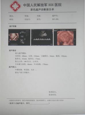 kg/jw-170醫(yī)用干式膠片