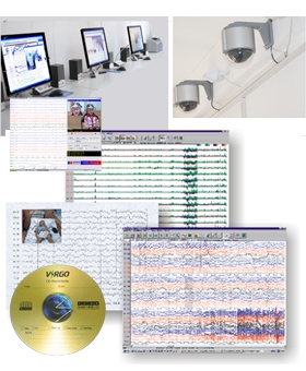 數字化視頻腦電監護分析系統