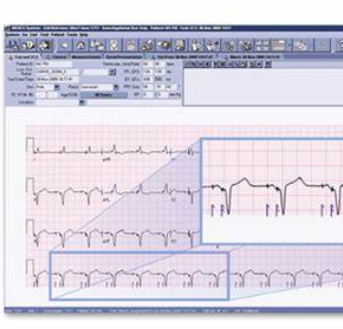 iCV net心電信息管理系統