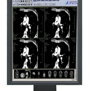 醫學影像處理系統RCZ-200D