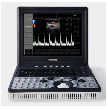 便攜式全數字彩色多普勒超聲診斷系統(tǒng)d3