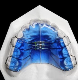 華偉定制式矯治器擴弓型、矯治保持型、牙膠片型