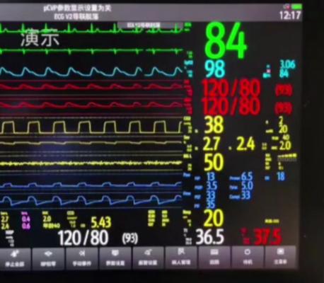 心臟遠程移動監護系統